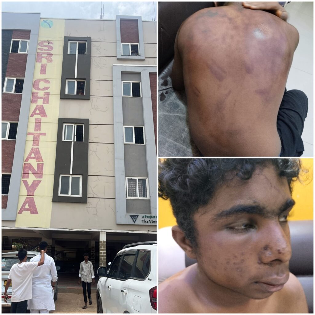 *శ్రీచైతన్య హైస్కూల్ హాస్టల్‌లో పదో తరగతి విద్యార్థిపై అభిషేక్ తోటి విద్యార్థుల దాడి.* *కర్రలు, ప్లేట్లతో దారుణంగా దాడి చేసిన ఉదంతం తీవ్ర కలకలం రేపుతోంది.* *విద్యాసంస్థల్లో భద్రత, పర్యవేక్షణ లోపాన్ని ప్రశ్నిస్తూ సామాజిక మాధ్యమాల్లో వ్యక్తమవుతున్న తీవ్ర ఆందోళనలు ముమ్మాటికీ న్యాయమైనవి.* *వినయం లేని విద్యలు, బతుకు నేర్పని పాఠాలు, లక్షల్లో ఫీజులు*..